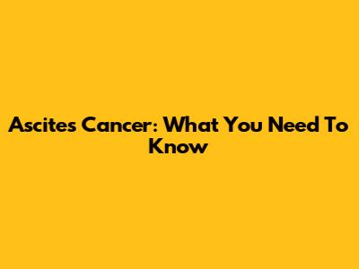 Ascites Cancer: What You Need To Know
