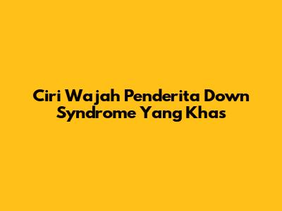 Ciri Wajah Penderita Down Syndrome Yang Khas