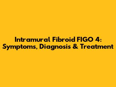 Intramural Fibroid FIGO 4: Symptoms, Diagnosis & Treatment