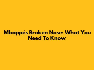 Mbappé's Broken Nose: What You Need To Know